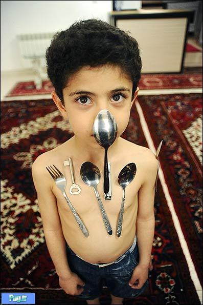 متین ، کودکی با بدن عجیب در تبریز ! + عکس
