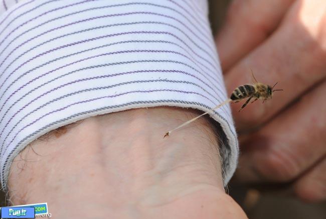 نیش زدن یک زنبور عسل