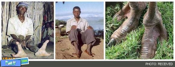 پاهای شترمرغی یک قبیله در افریقا +عکس