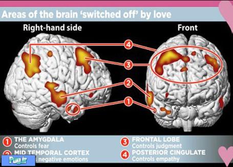 عکس: اسکن مغز یک عاشق؛ همه تغییرات مغز در هنگام عاشق شدن!