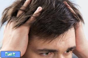 خبرهای نوید بخش در درمان ریزش مو