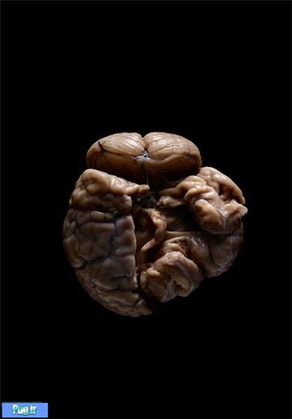 مغز انسان های متفاوت 