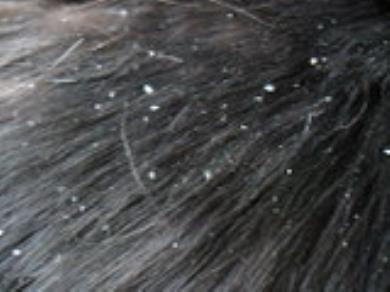 شوره موی گربه های Dandruff 