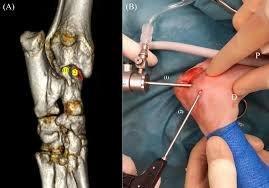 ارتروسکوپی پرشین پت